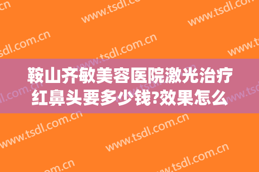 鞍山齐敏美容医院激光治疗红鼻头要多少钱?效果怎么样?(鞍山齐敏美容医院地址)