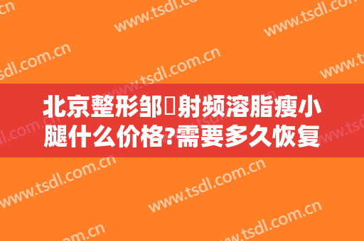 北京整形邹翀射频溶脂瘦小腿什么价格?需要多久恢复?