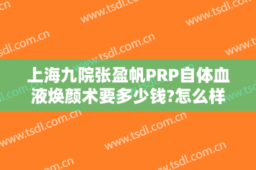 上海九院张盈帆PRP自体血液焕颜术要多少钱?怎么样?