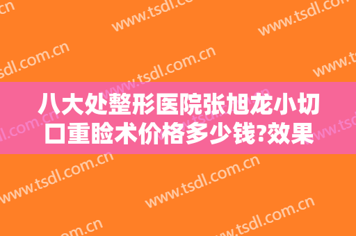 八大处整形医院张旭龙小切口重睑术价格多少钱?效果怎么样?