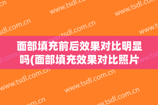 面部填充前后效果对比明显吗(面部填充效果对比照片)