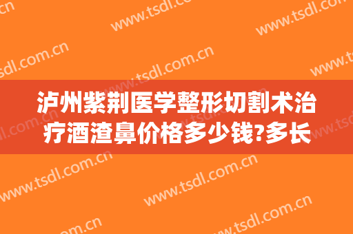 泸州紫荆医学整形切割术治疗酒渣鼻价格多少钱?多长时间恢复?(泸州紫荆整形美容医院)