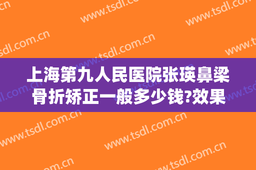 上海第九人民医院张瑛鼻梁骨折矫正一般多少钱?效果怎么样?(上海市第九人民医院鼻子骨折费用)