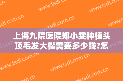 上海九院医院郑小雯种植头顶毛发大楷需要多少钱?怎么样?
