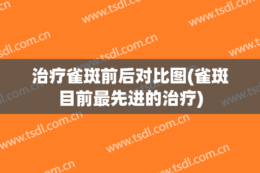 治疗雀斑前后对比图(雀斑目前最先进的治疗)
