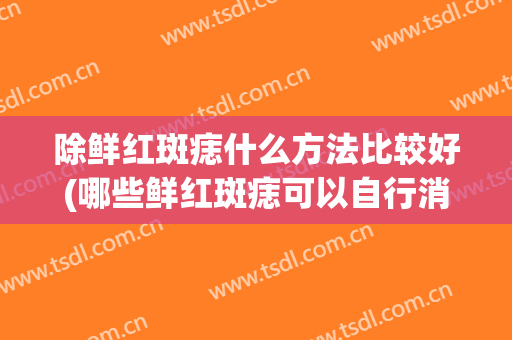 除鲜红斑痣什么方法比较好(哪些鲜红斑痣可以自行消退)